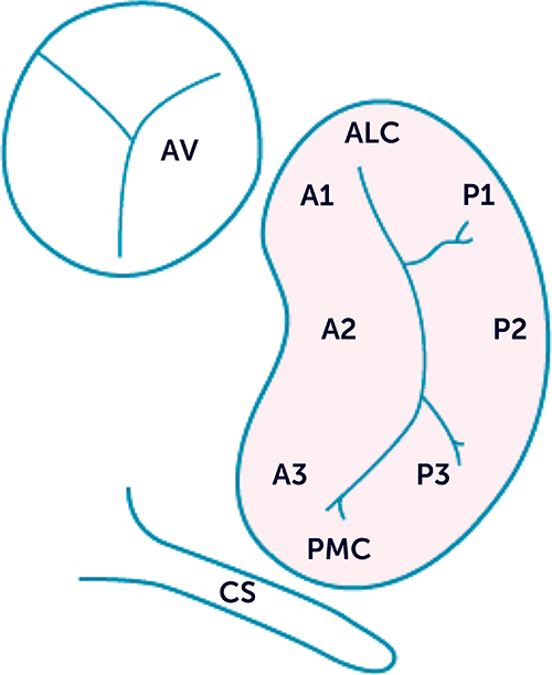 Carpentier's classification of the mitral valve