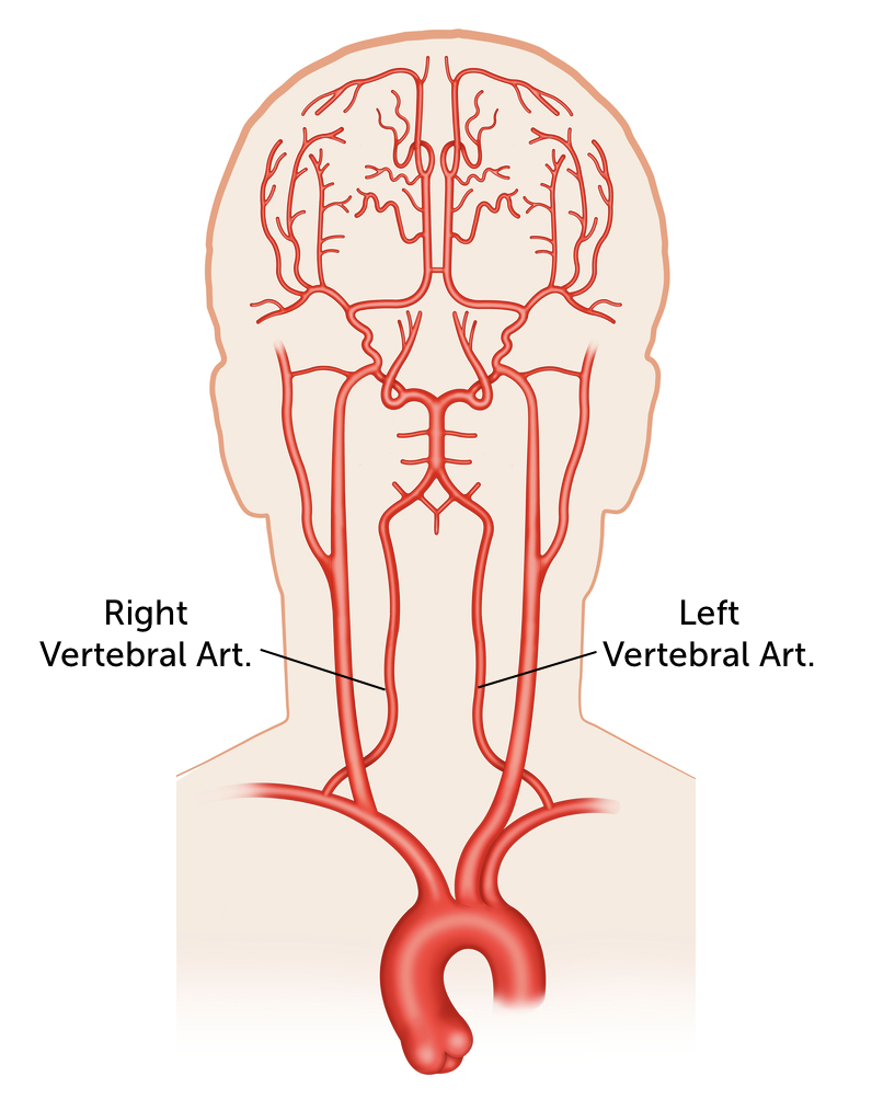 Гипоплазия правой артерии головного мозга. Позвоночная артерия. Правая и левая позвоночные артерии. Правая позвоночная артерия. Позвоночная артерия сегменты анатомия.
