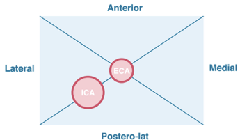 8 Eca Vs Ica External Versus Internal Carotid Artery 123 Sonography