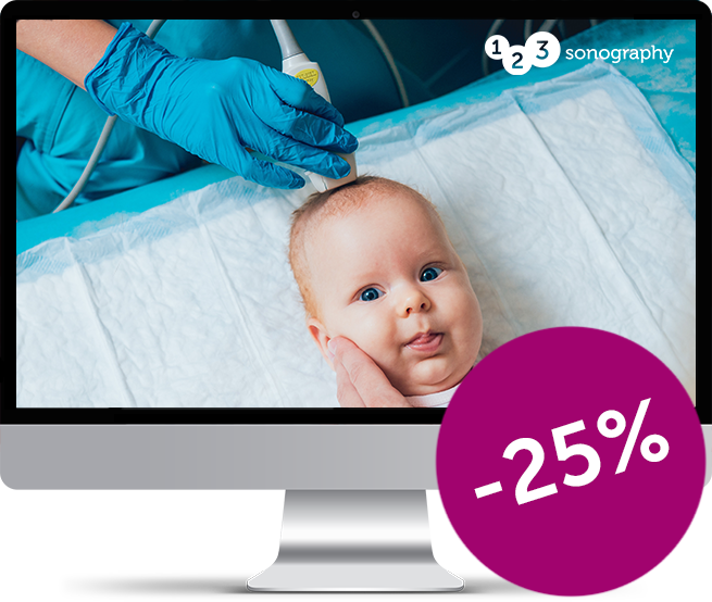 Baby with an ultrasound probe on their head on a Mac desktop with round CTA with text '-25%'.