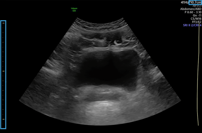 Medical illustration showing a hand holding an ultrasound machine