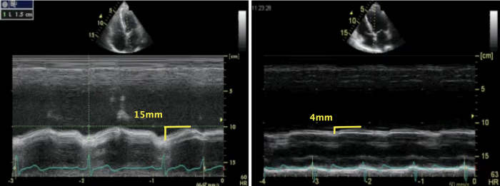 ultrasound, echo, cardiography, sonography