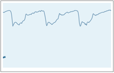 Stage 3 Spectral Doppler