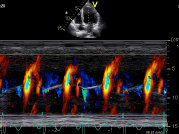 M-Mode imaging 123 Sonography