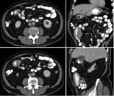 CT Axial – Coronal –Sagittal