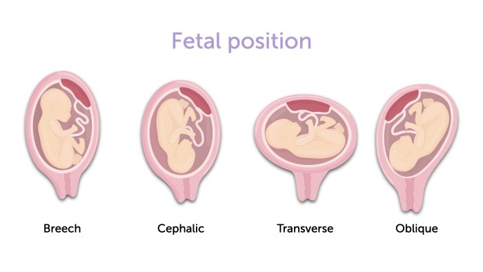 Illustration of different fetal positions.