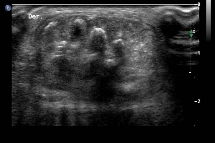 Tranversal view of posterior region, distal segment of right leg