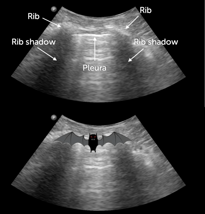 Bat sign ultrasound image with labels.