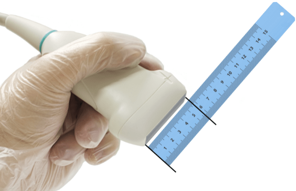 transducer phased array transducer, ultrasound