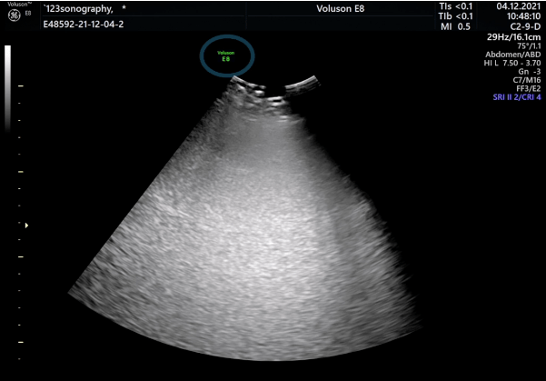 ultrasound image, sonography