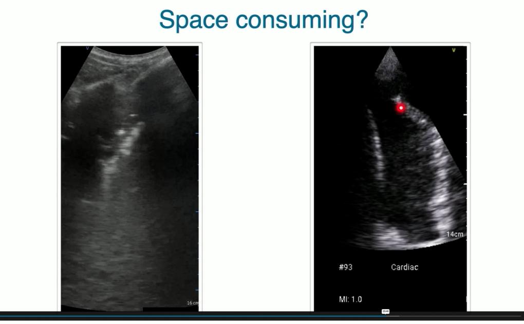 Lung ultrasound: Space consuming or not?