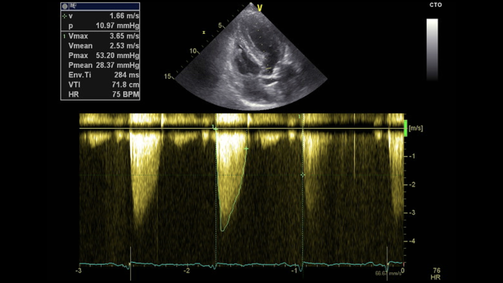  Transthoracic echocardiogram.