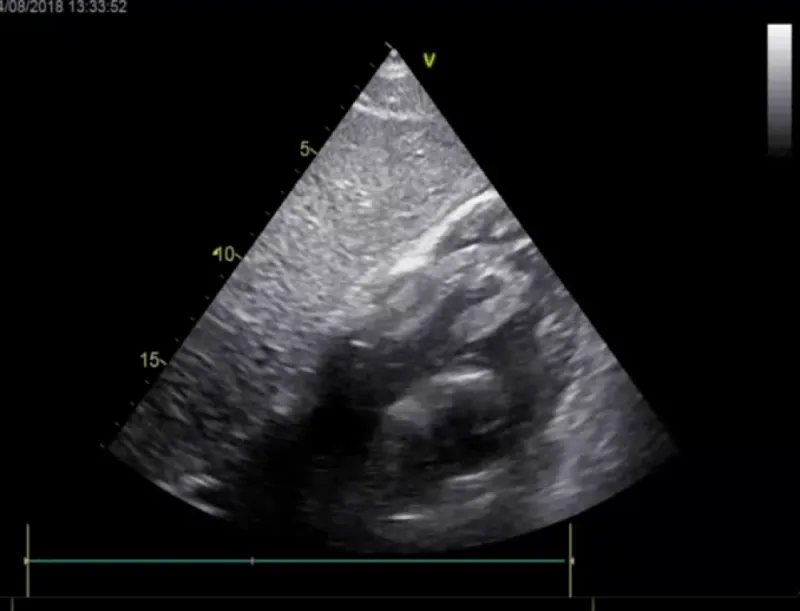 snake sign answer