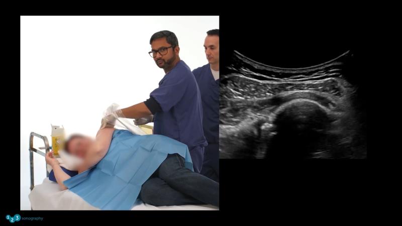 MSK Shoulder Injection with ultrasound image.