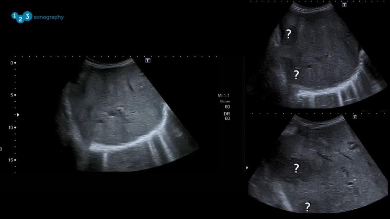 Abdominal ultrasound image.