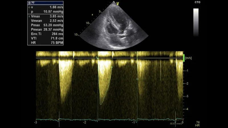  Transthoracic echocardiogram.