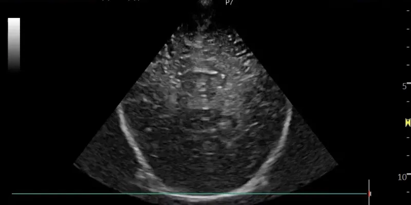 123sonography