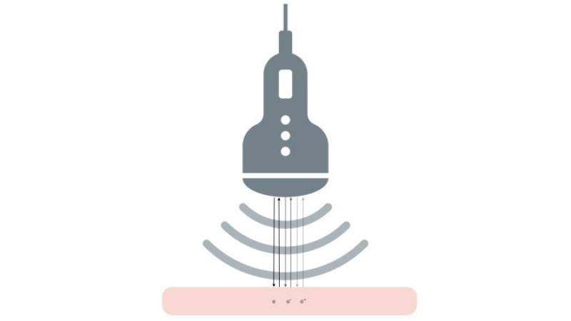 Ultrasound illustration reverberation.
