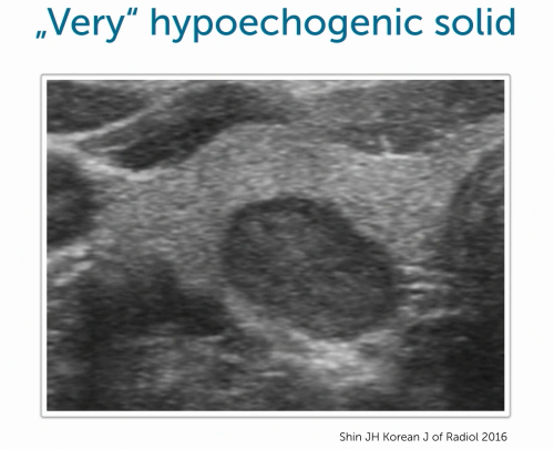 Thyroid Ultrasound: Very hypoechogenic solid.