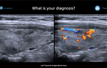 Thyroid ultrasound image.