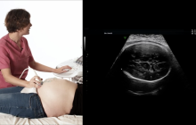 Still image of ultrasound in late pregnancy.