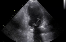 Ultrasound image.