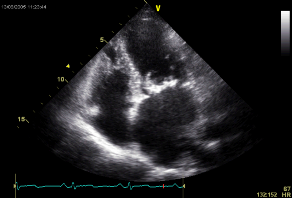 Take a Guess - Indian Hockey | 123 Sonography