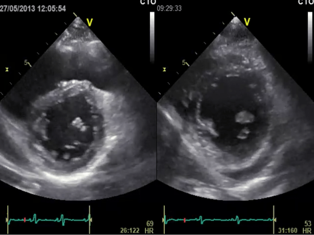 Christmas Ultrasound Miracles – Part 2 | 123 Sonography