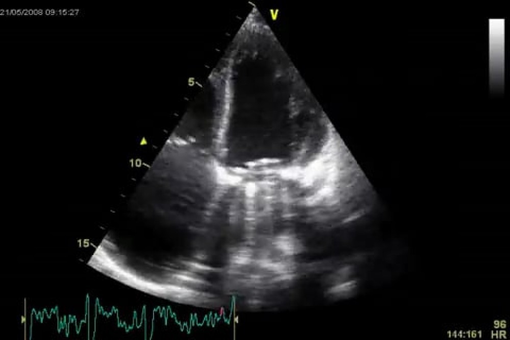 1.4 Bioeffects of Ultrasound | 123 Sonography