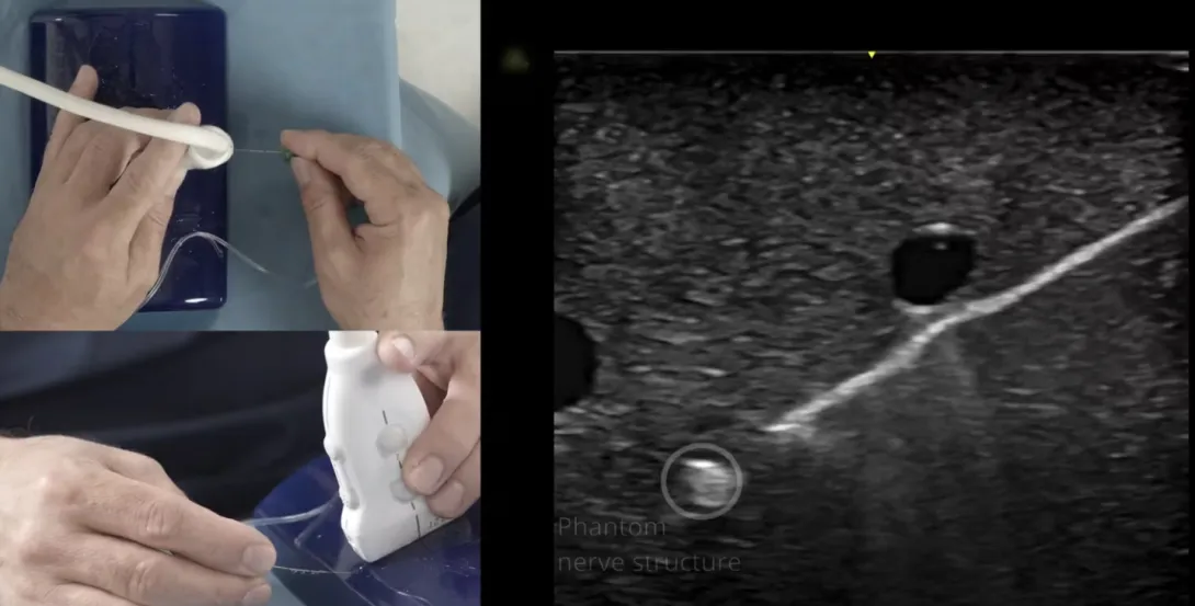 Cannula approaches