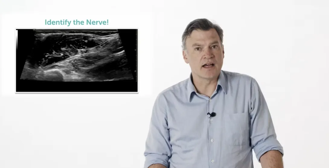 Test your knowledge - Upper Extremity Nerve and Plexus Blocks