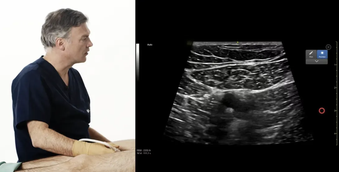Lower Extremity Blocks - Part 1