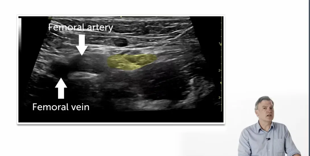 Test your knowledge - Lower Extremity Blocks