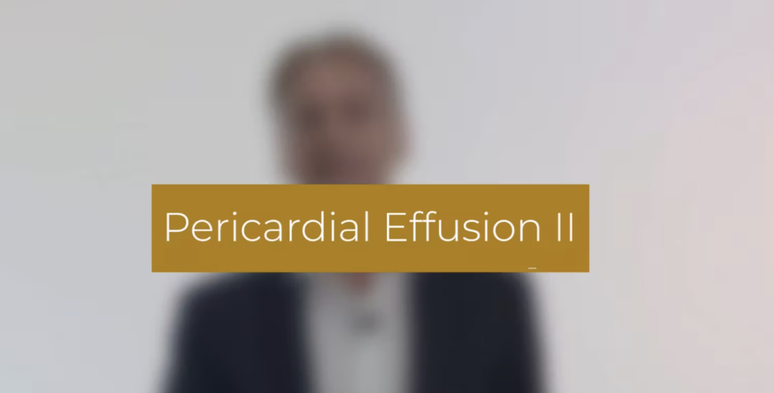 Pericardial Effusion II