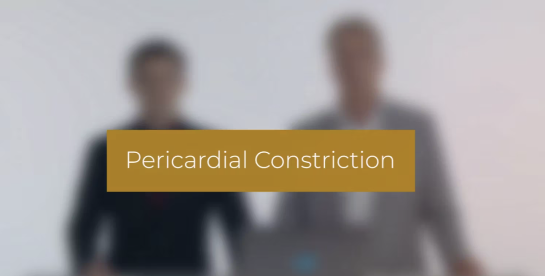 Pericardial constriction