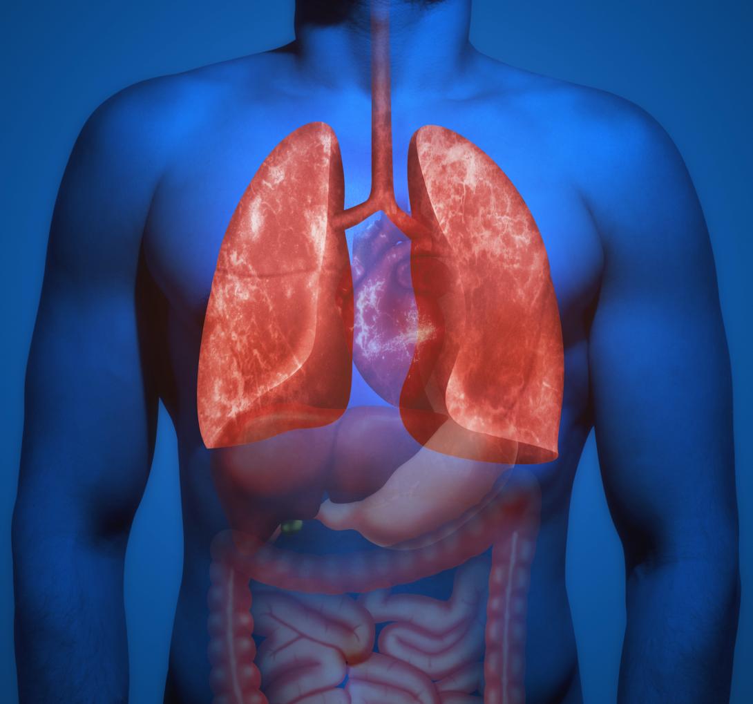 Basics of lung ultrasound - Pleural effusion, B-Lines and Pneumothorax