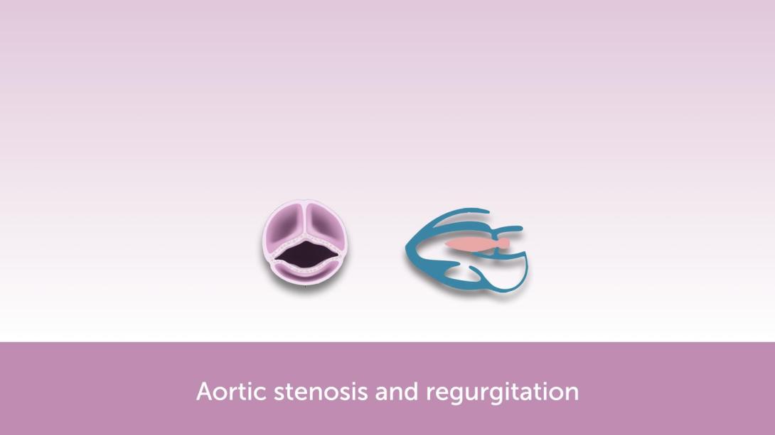 Aortic Valve Disease FocusClass - coming soon (Q4 2024)