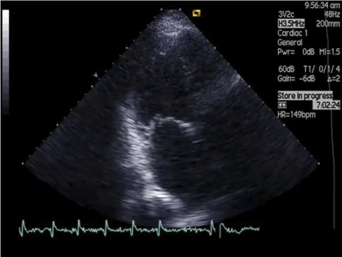 Apical long axis view, anything abnormal?