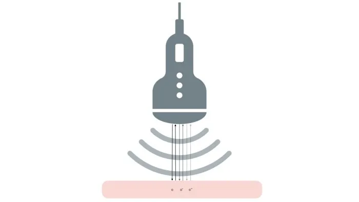 Ultrasound illustration reverberation.