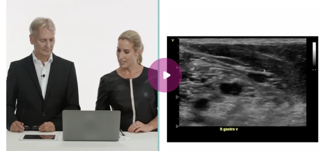 Vascular Lower Extremity Patient Case video thumbnail.