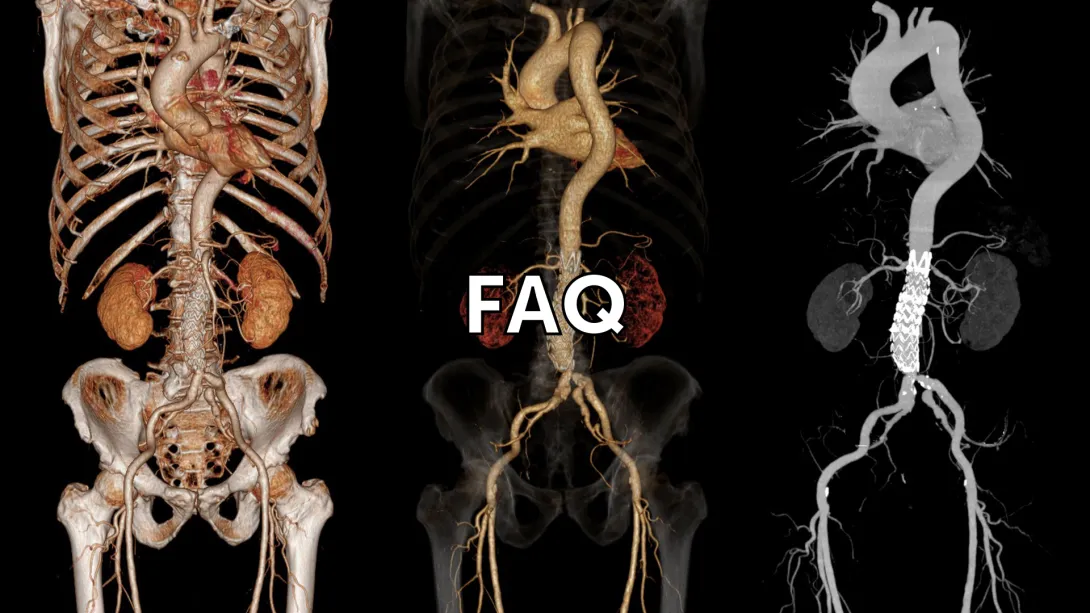 What If the Aorta Is Diseased - But There’s No Syndrome?