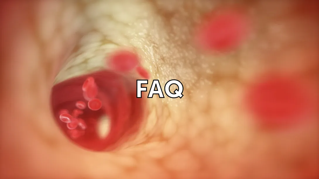 What is new in the ACS and chronic CAD GL?