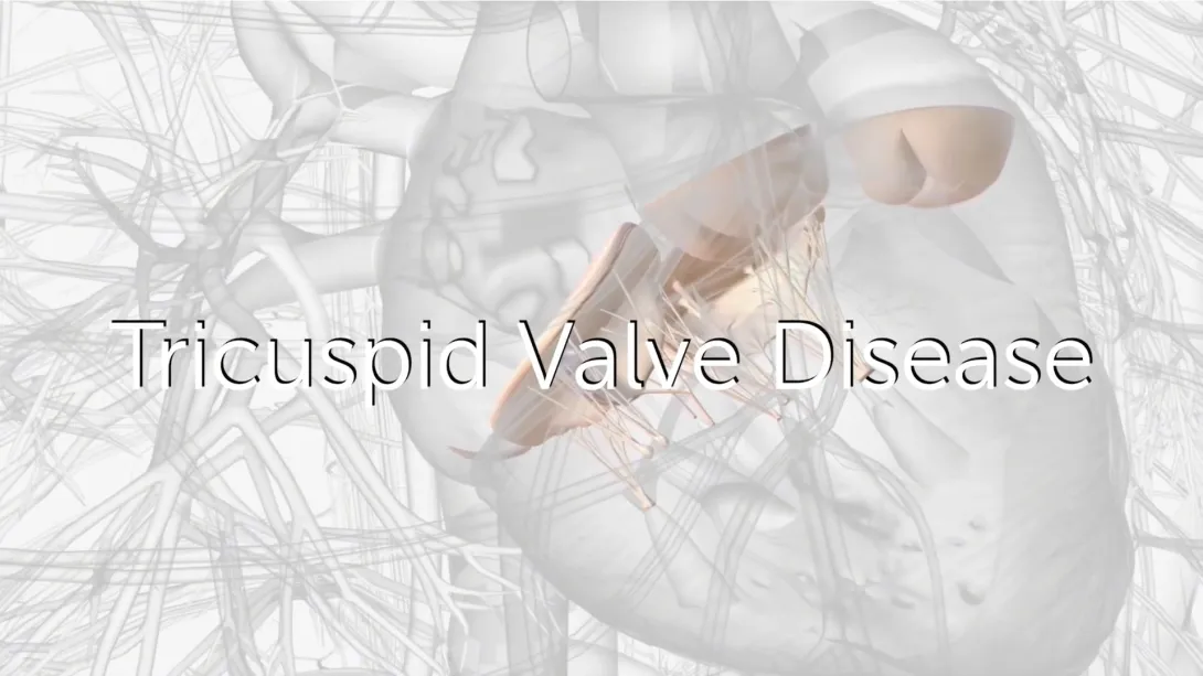 How Do You Approach Tricuspid Regurgitation With Echocardiography (Step-By-Step)?