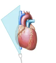 Cut plane of the subcostal vena cava view
