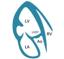 Apical three chamber view