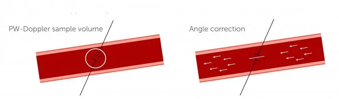 021_angle_correction