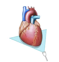 Coronary Sinus View