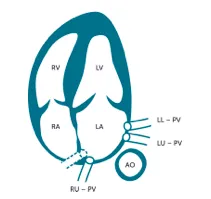 Apical four chamber view