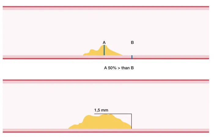 10.2_plaque_measurement