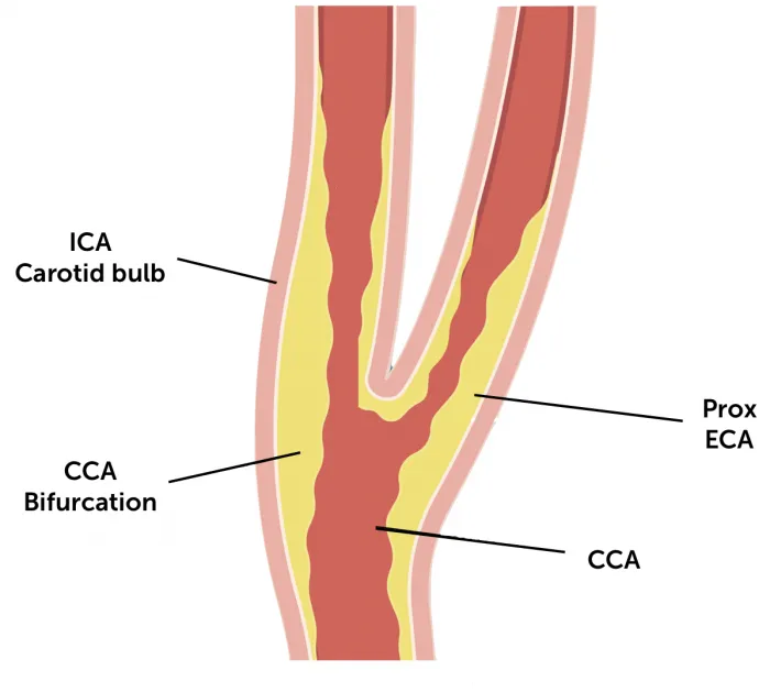 10.8_location_of_plaque_ill
